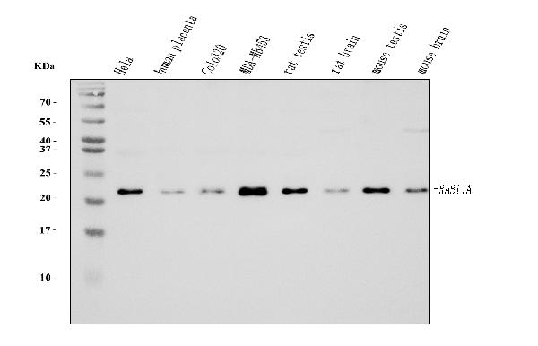1 - Anti-Rab11A Antibody Picoband™ (monoclonal, 4H9) ABO15077
