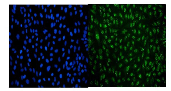3 - Anti-LSM8 Antibody Picoband™ (monoclonal, 6B11) ABO15078