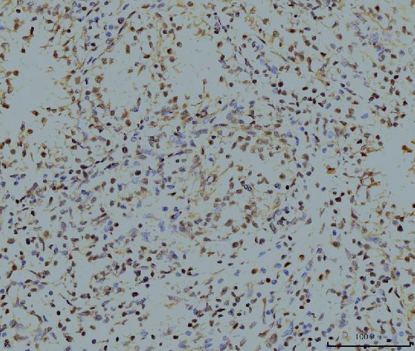 2 - Anti-LSM8 Antibody Picoband™ (monoclonal, 6B11) ABO15078