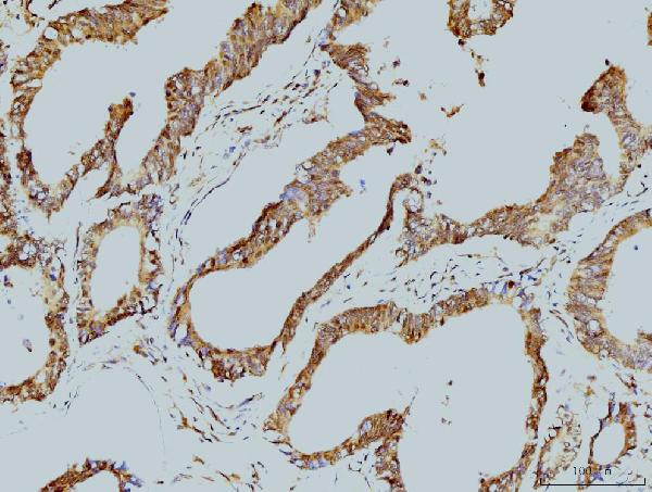 2 - Anti-LSM8 Antibody Picoband™ (monoclonal, 6B11) ABO15078