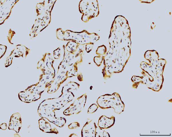 2 - Anti-LSM8 Antibody Picoband™ (monoclonal, 6B11) ABO15078
