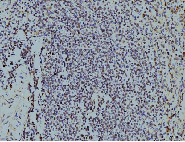 2 - Anti-LSM8 Antibody Picoband™ (monoclonal, 6B11) ABO15078
