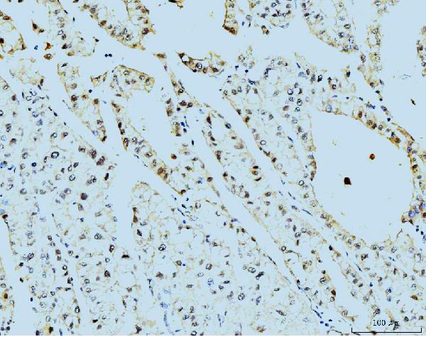 2 - Anti-TBP-1/PSMC3 Antibody Picoband™ (monoclonal, 4D3) ABO15079