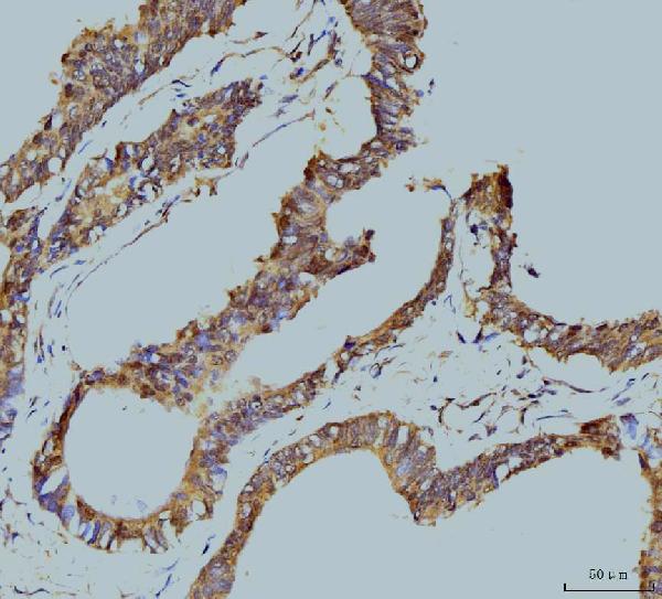 2 - Anti-TBP-1/PSMC3 Antibody Picoband™ (monoclonal, 4D3) ABO15079