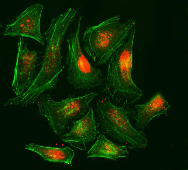3 - Anti-RPA32/RPA2 Antibody Picoband™ (monoclonal, 3B2E9) ABO15081