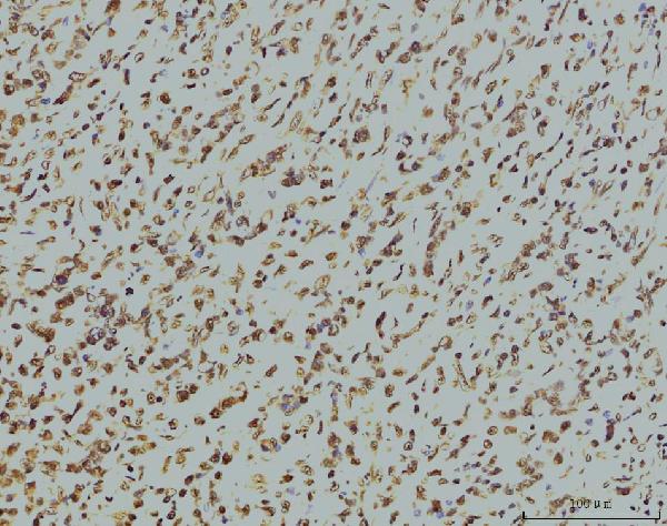 2 - Anti-RPA32/RPA2 Antibody Picoband™ (monoclonal, 3B2E9) ABO15081