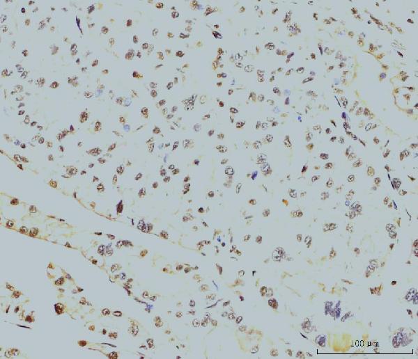 2 - Anti-RPA32/RPA2 Antibody Picoband™ (monoclonal, 3B2E9) ABO15081