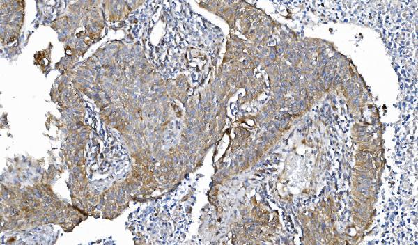 2 - Anti-POR Antibody Picoband™ (monoclonal, 7F5) ABO15083
