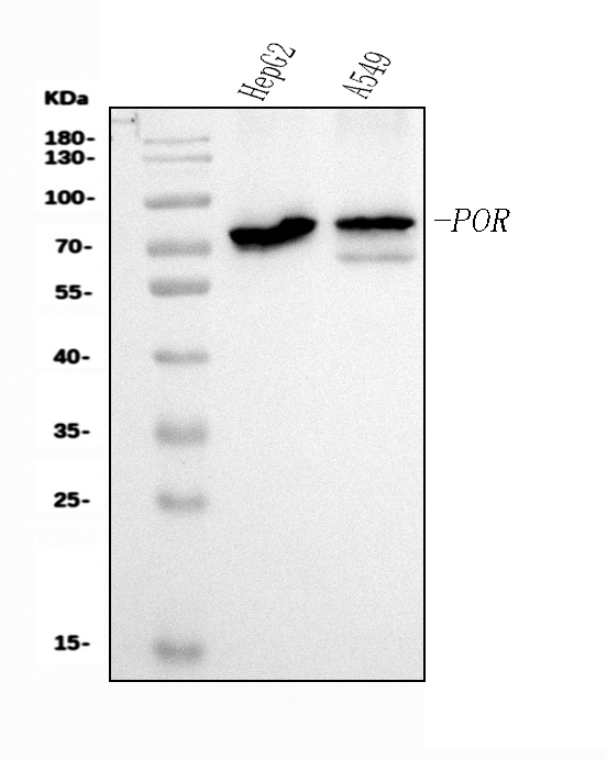 1 - Anti-POR Antibody Picoband™ (monoclonal, 7F5) ABO15083