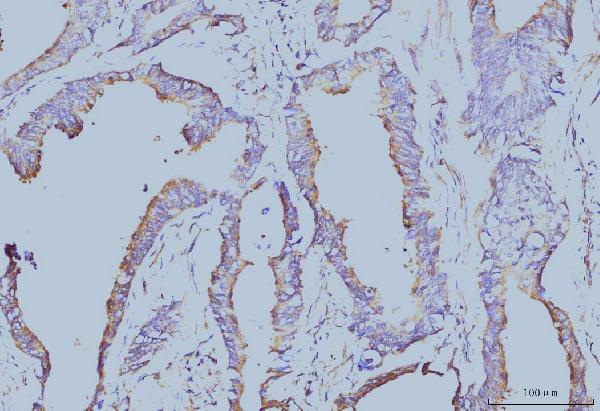 2 - Anti-EIF4A1 Antibody Picoband™ (monoclonal, 3F11) ABO15085