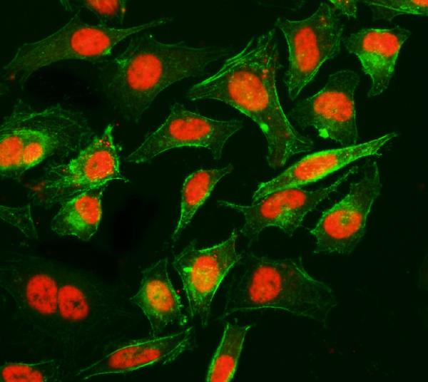 3 - Anti-Cyclophilin E/PPIE Antibody Picoband™ (monoclonal, 4I9) ABO15086