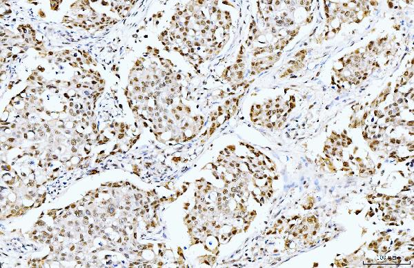 2 - Anti-Cyclophilin E/PPIE Antibody Picoband™ (monoclonal, 4I9) ABO15086