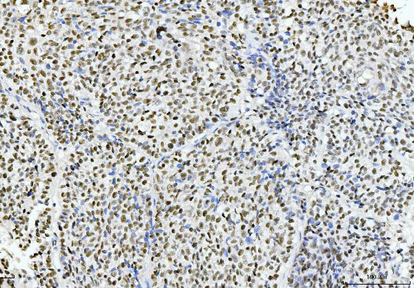 2 - Anti-Cyclophilin E/PPIE Antibody Picoband™ (monoclonal, 4I9) ABO15086