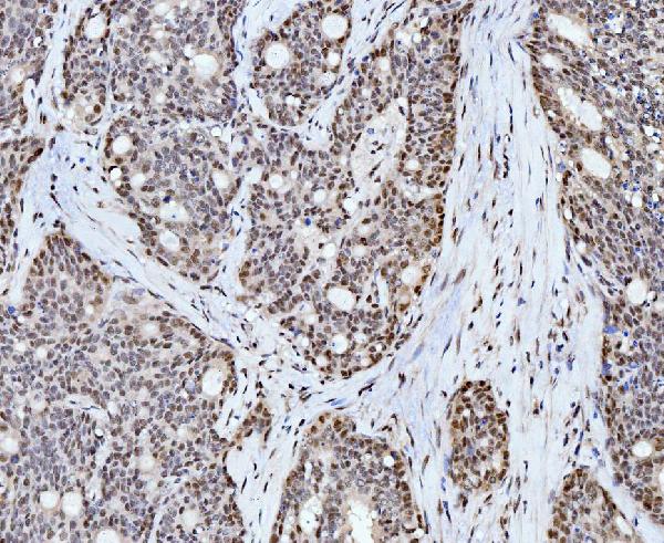 2 - Anti-Cyclophilin E/PPIE Antibody Picoband™ (monoclonal, 4I9) ABO15086