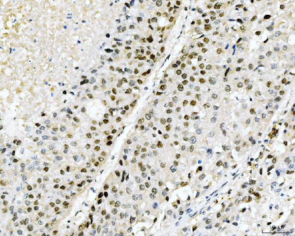 2 - Anti-Cyclophilin E/PPIE Antibody Picoband™ (monoclonal, 4I9) ABO15086
