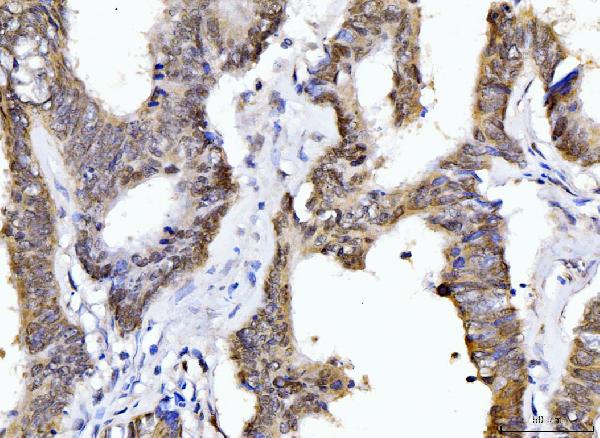 2 - Anti-Cyclophilin E/PPIE Antibody Picoband™ (monoclonal, 4I9) ABO15086