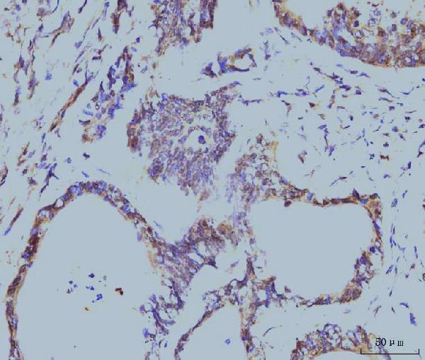 2 - Anti-Cyclophilin E/PPIE Antibody Picoband™ (monoclonal, 7F2) ABO15087