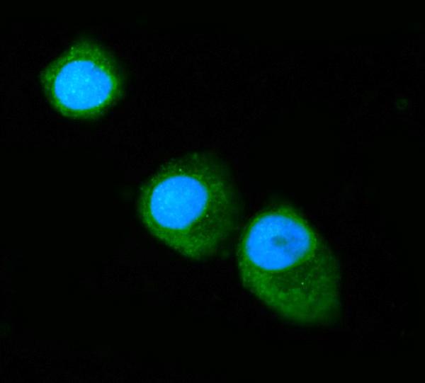 3 - Anti-Annexin VI Antibody Picoband™ (monoclonal, 4C4) ABO15088