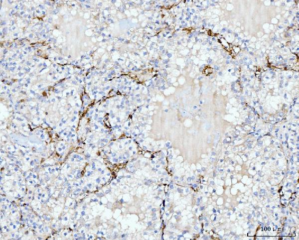 2 - Anti-FABP4 Antibody Picoband™ (monoclonal, 10E12) ABO15089