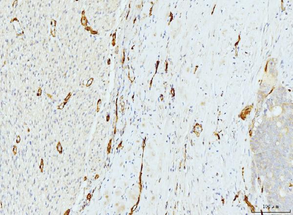 2 - Anti-FABP4 Antibody Picoband™ (monoclonal, 10E12) ABO15089