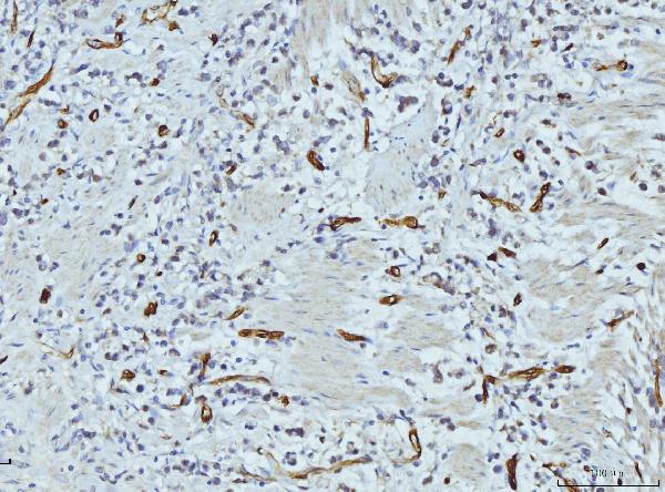2 - Anti-FABP4 Antibody Picoband™ (monoclonal, 10E12) ABO15089