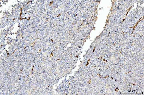 2 - Anti-FABP4 Antibody Picoband™ (monoclonal, 10E12) ABO15089
