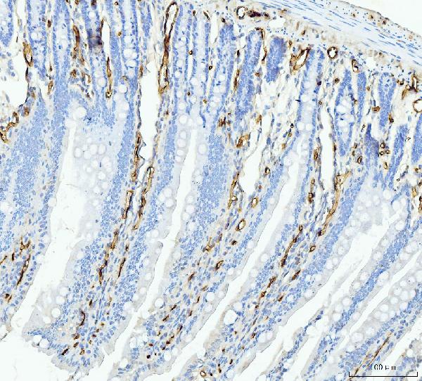 2 - Anti-FABP4 Antibody Picoband™ (monoclonal, 10E12) ABO15089