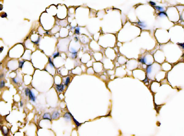 2 - Anti-FABP4 Antibody Picoband™ (monoclonal, 10E12) ABO15089