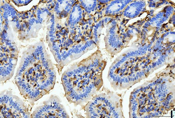 2 - Anti-FABP4 Antibody Picoband™ (monoclonal, 10E12) ABO15089