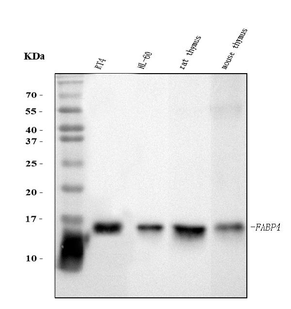 1 - Anti-FABP4 Antibody Picoband™ (monoclonal, 10E12) ABO15089