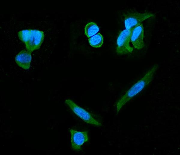 3 - Anti-PDE6 beta/PDE6B Antibody Picoband™ (monoclonal, 8I2F10) ABO15091