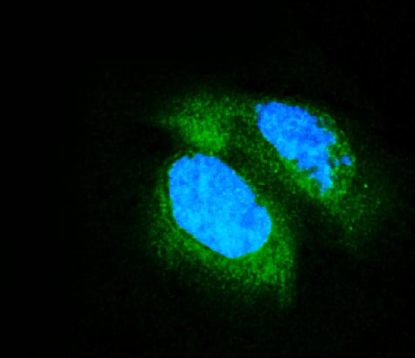 3 - Anti-PDE6 beta/PDE6B Antibody Picoband™ (monoclonal, 8I2D7) ABO15092