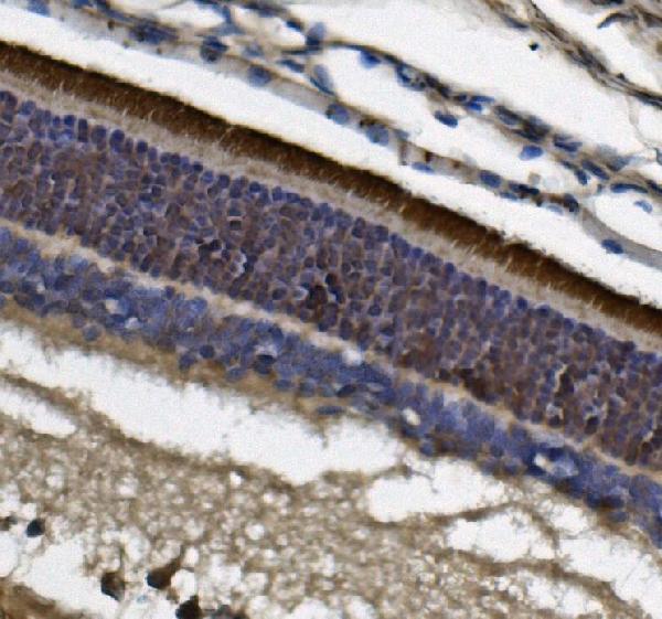 2 - Anti-PDE6 beta/PDE6B Antibody Picoband™ (monoclonal, 8I2D7) ABO15092