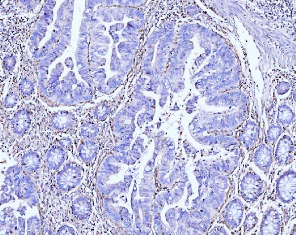 2 - Anti-Moesin/MSN Antibody Picoband™ (monoclonal, 8D4) ABO15093