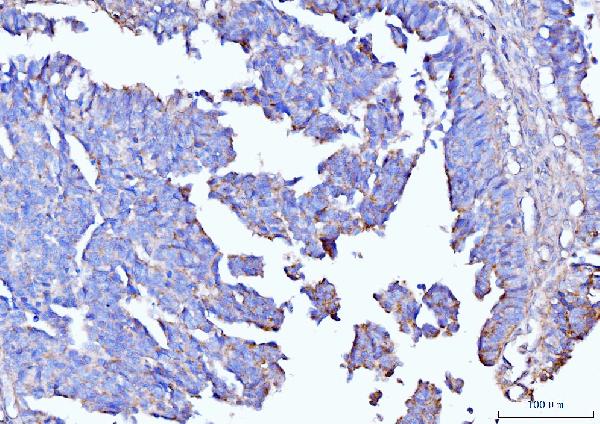 2 - Anti-Moesin/MSN Antibody Picoband™ (monoclonal, 8D4) ABO15093