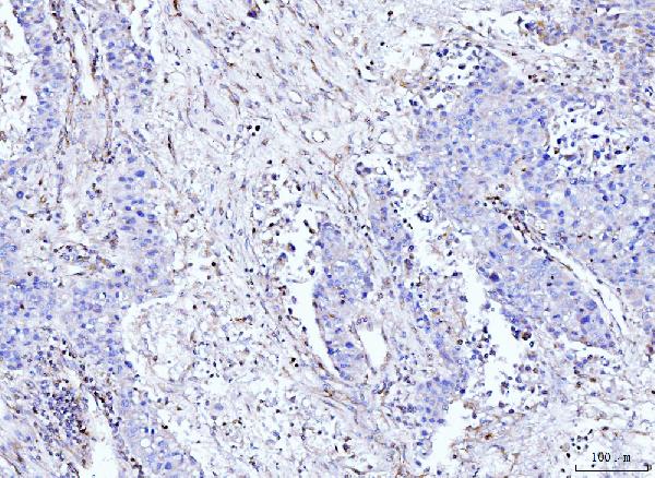 2 - Anti-Moesin/MSN Antibody Picoband™ (monoclonal, 8D4) ABO15093