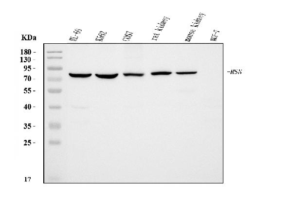 1 - Anti-Moesin/MSN Antibody Picoband™ (monoclonal, 8D4) ABO15093