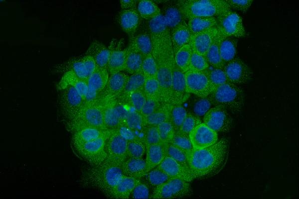 3 - Anti-Cytokeratin 5 Antibody Picoband™ (monoclonal, 5D3F7) ABO15094