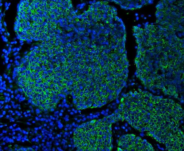 3 - Anti-Cytokeratin 5 Antibody Picoband™ (monoclonal, 5D3F7) ABO15094