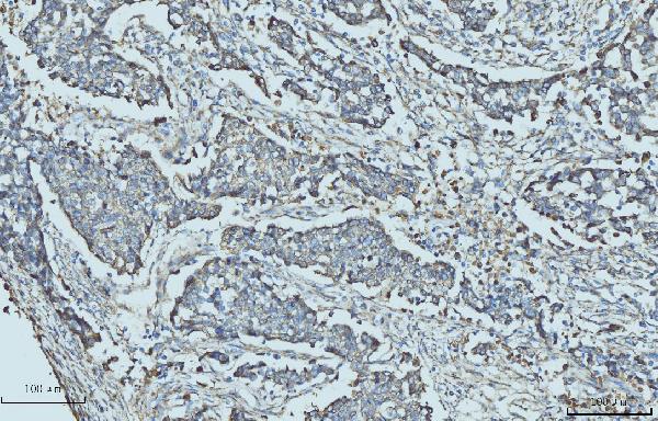 2 - Anti-Cytokeratin 5 Antibody Picoband™ (monoclonal, 5D3F7) ABO15094