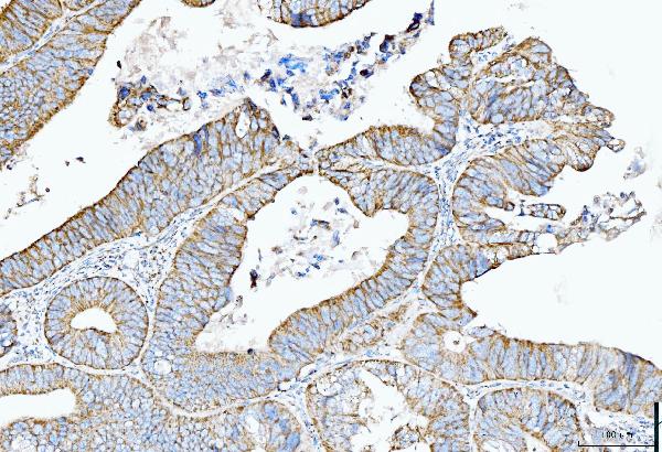 2 - Anti-Cytokeratin 5 Antibody Picoband™ (monoclonal, 5D3F7) ABO15094