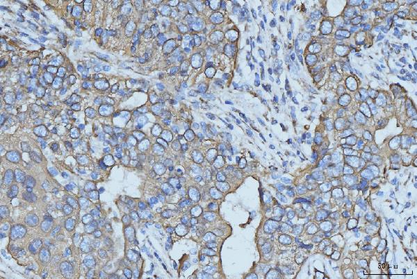 2 - Anti-Cytokeratin 5 Antibody Picoband™ (monoclonal, 5D3F7) ABO15094