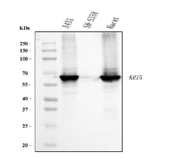 1 - Anti-Cytokeratin 5 Antibody Picoband™ (monoclonal, 5D3F7) ABO15094