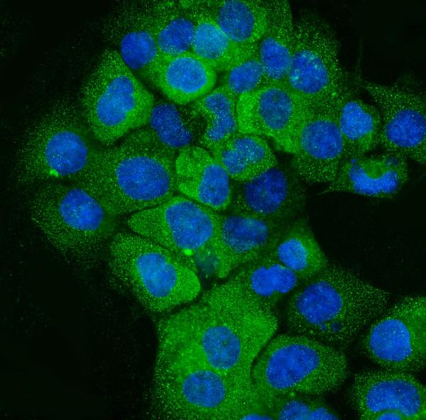 3 - Anti-Cytokeratin 5 Antibody Picoband™ (monoclonal, 9H2F8) ABO15095
