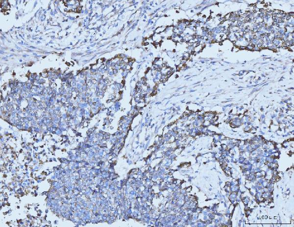 2 - Anti-Cytokeratin 5 Antibody Picoband™ (monoclonal, 9H2F8) ABO15095