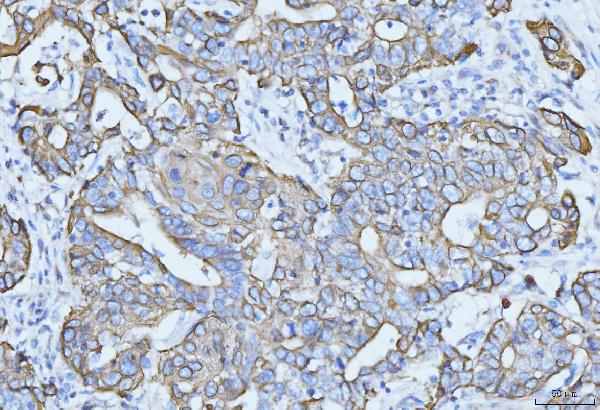 2 - Anti-Cytokeratin 5 Antibody Picoband™ (monoclonal, 9H2F8) ABO15095