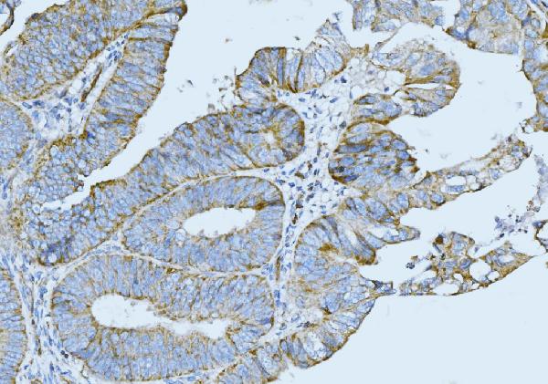2 - Anti-Cytokeratin 5 Antibody Picoband™ (monoclonal, 9H2F8) ABO15095