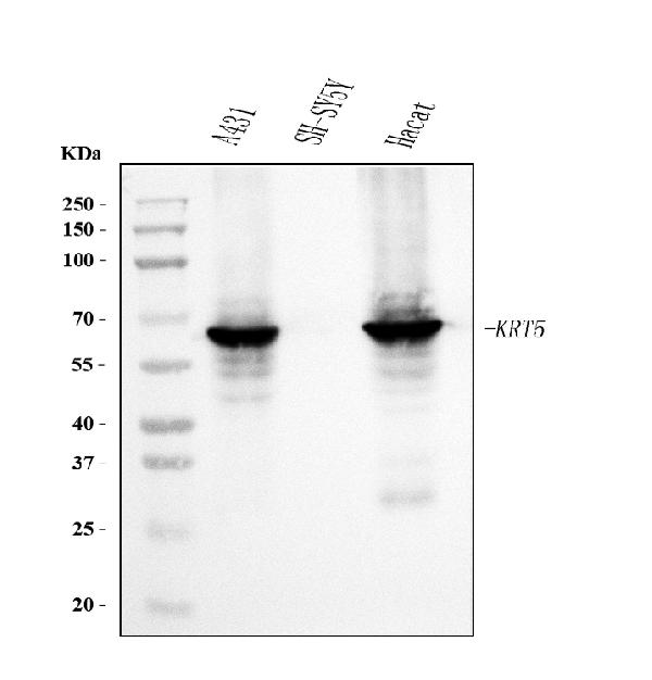 1 - Anti-Cytokeratin 5 Antibody Picoband™ (monoclonal, 9H2F8) ABO15095