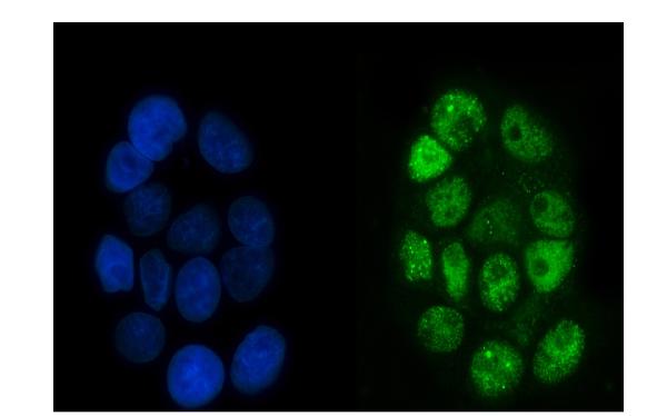 3 - Anti-p95 NBS1 Antibody Picoband™ (monoclonal, 5D7A1) ABO15096