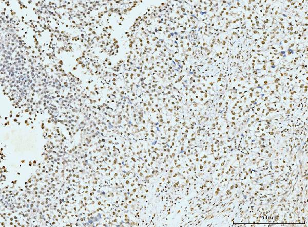 2 - Anti-p95 NBS1 Antibody Picoband™ (monoclonal, 5D7A1) ABO15096